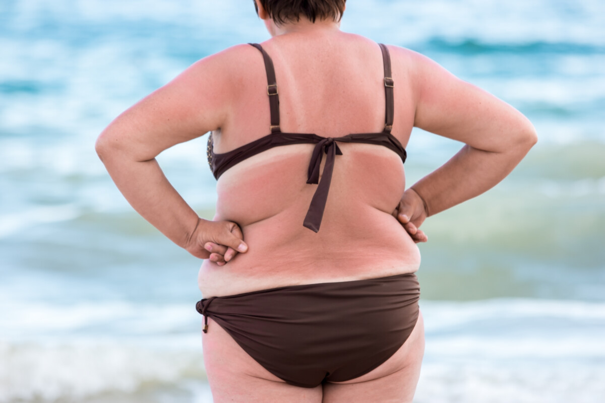 Grotesquely obese woman in bikini picture