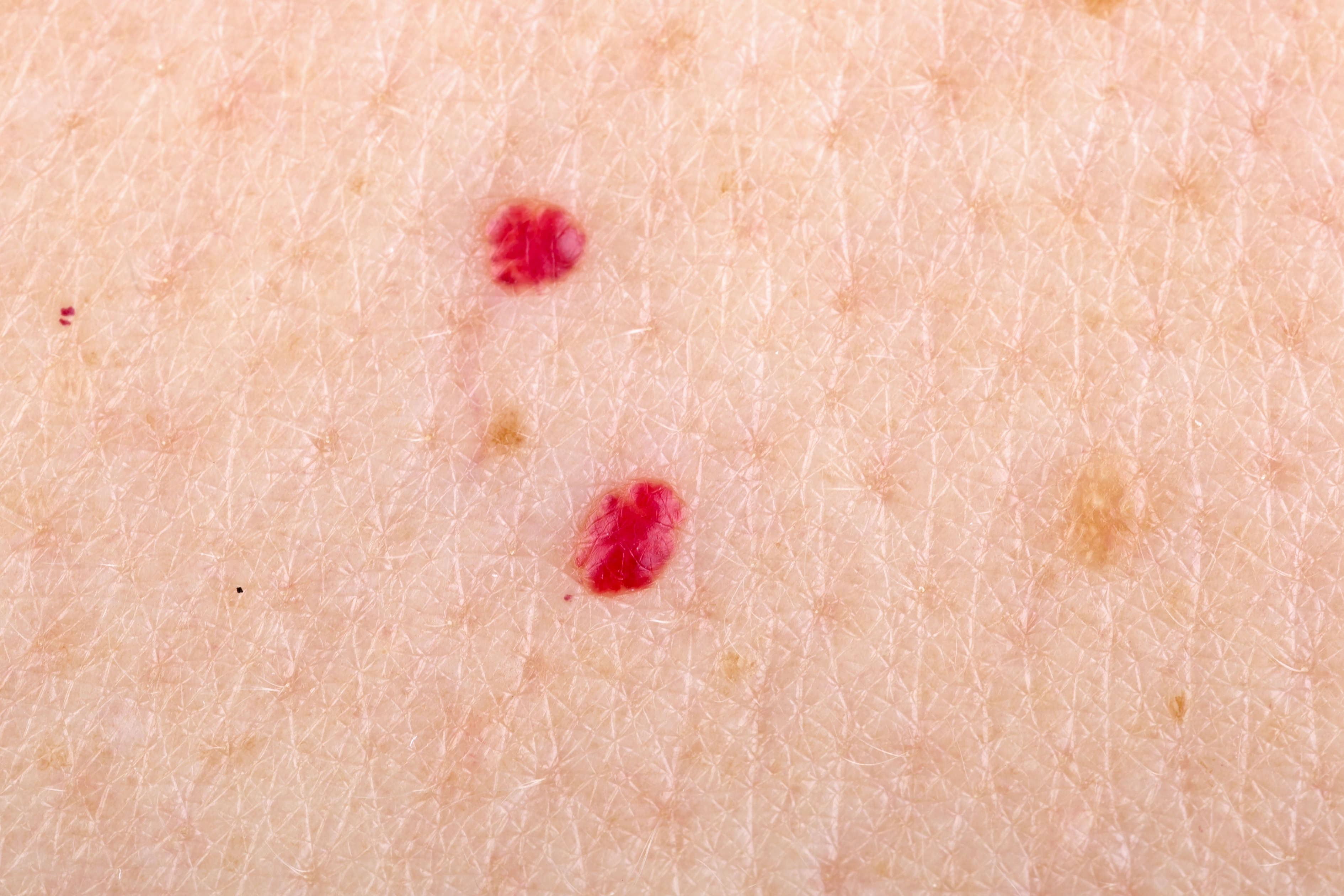 pinpoint red dots on skin stomach