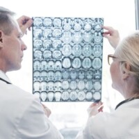 How Long a Brain Tumor Takes to Be Diagnosed in Adults
