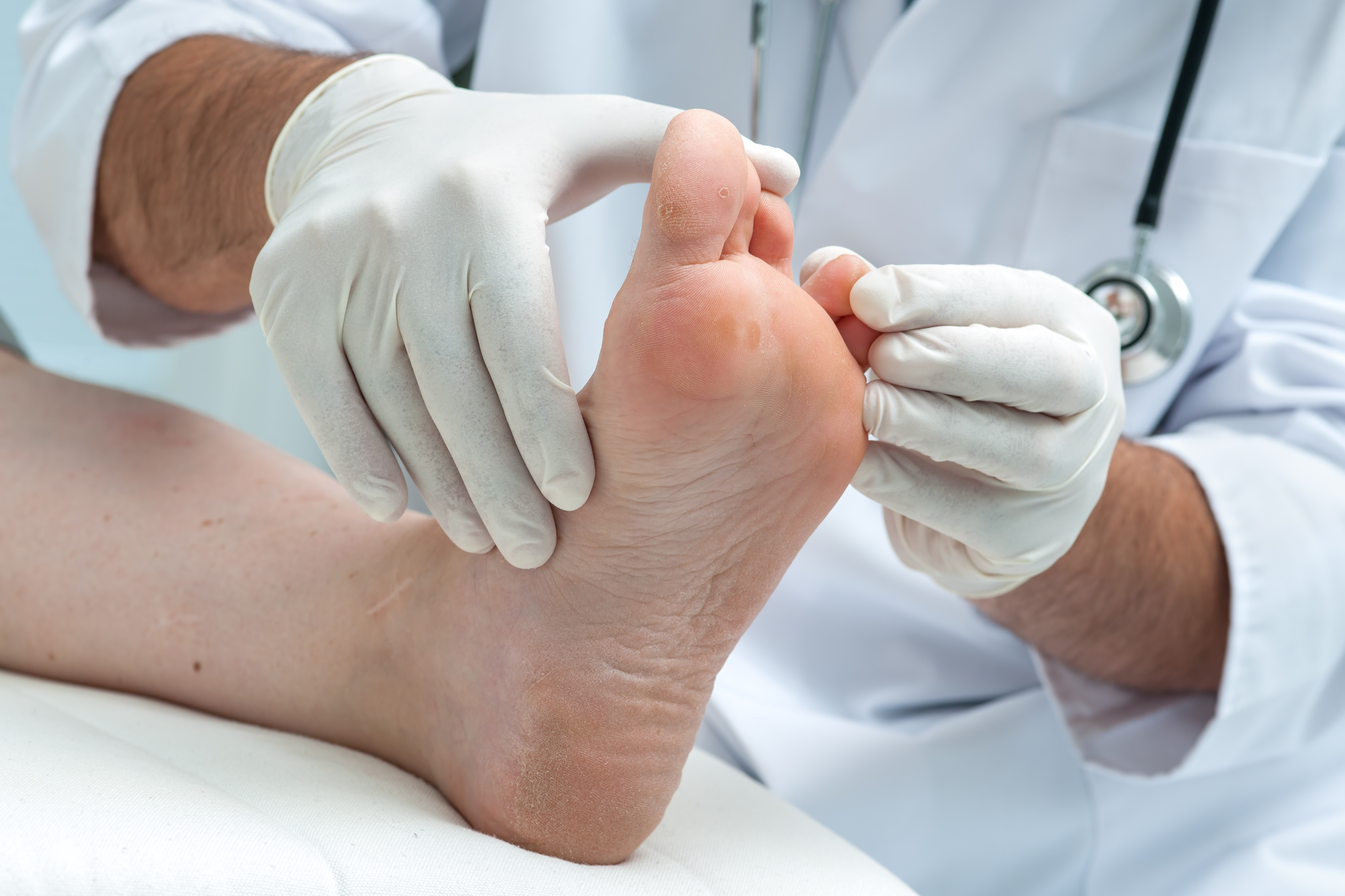 Jammed Toe vs. Broken Toe: What You Should Know