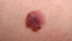 Spots of penis head red little on Causes of