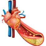 Does Normal Blood Pressure Mean You Don't Have Heart Disease?