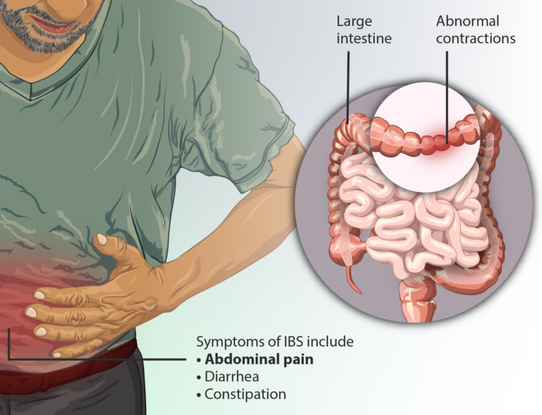 Can IBS Cause Ribbon Stools? » Scary Symptoms