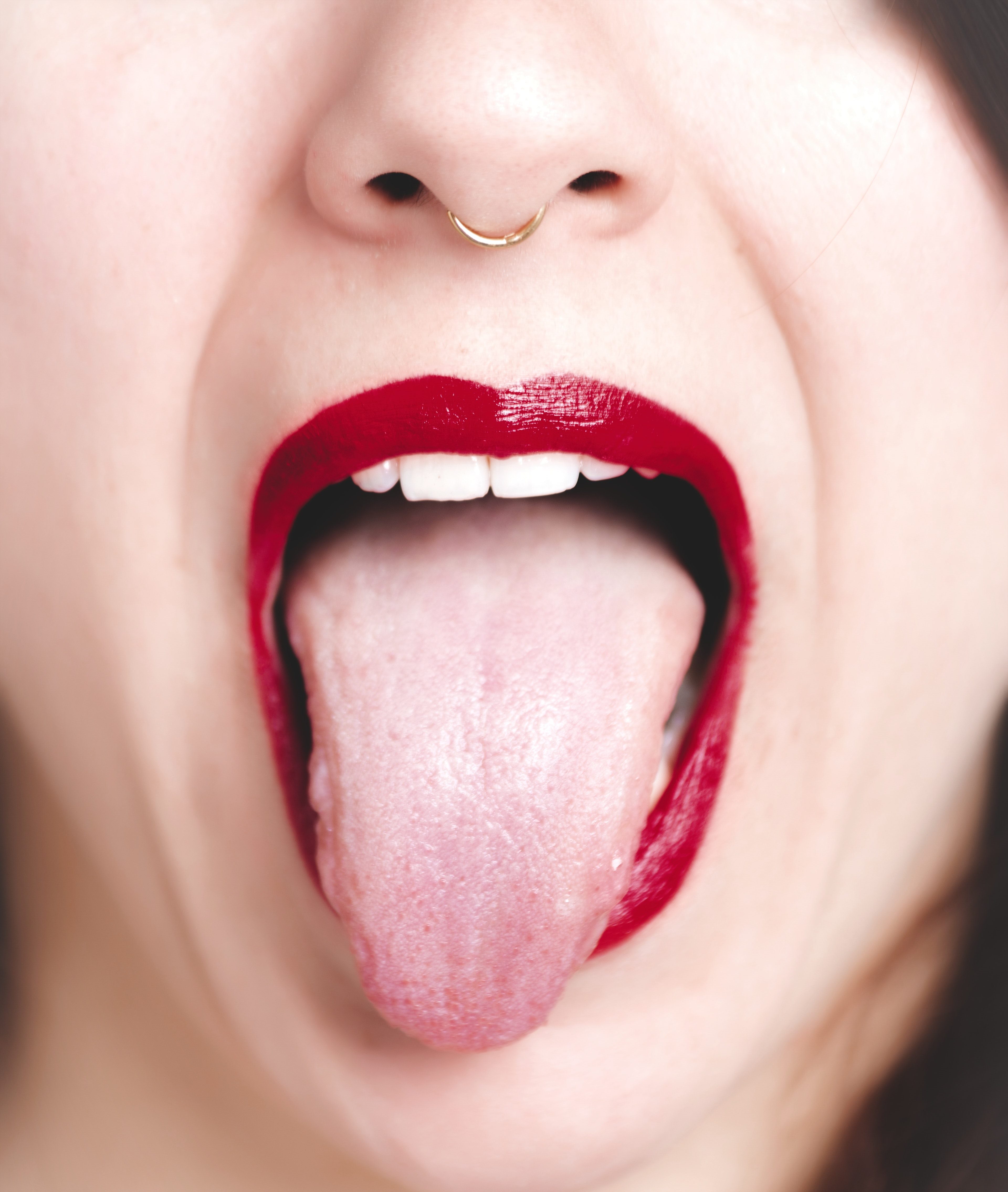 Bulbar Onset ALS vs. Normal Tongue Twitching