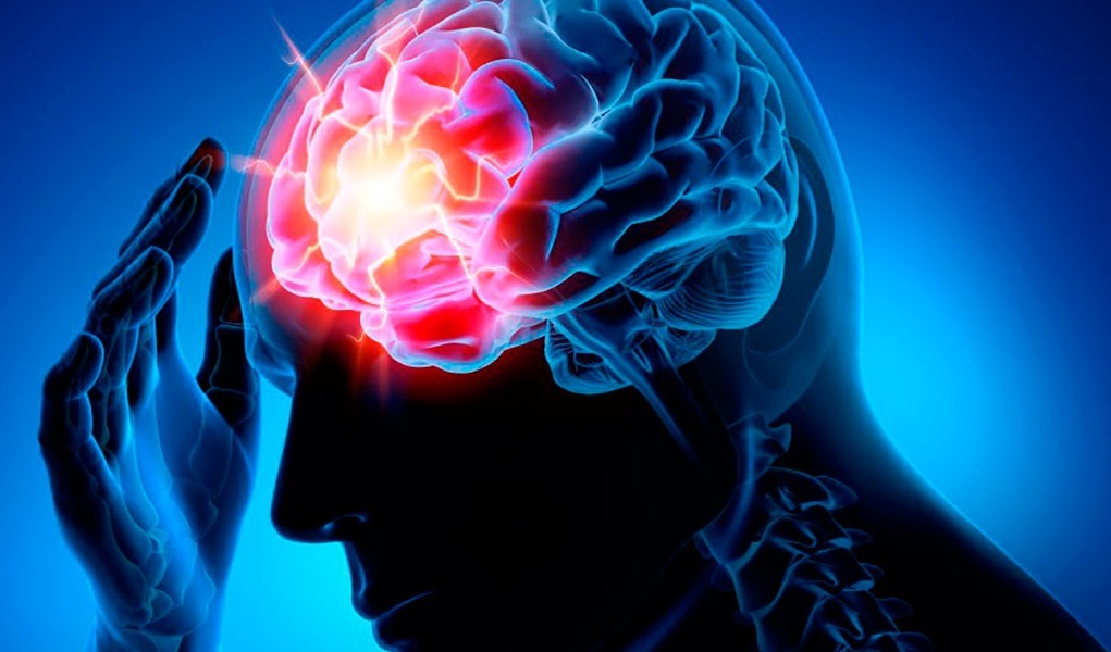 Vision Blackouts, Heartbeat in Ear, Headache: Brain Condition