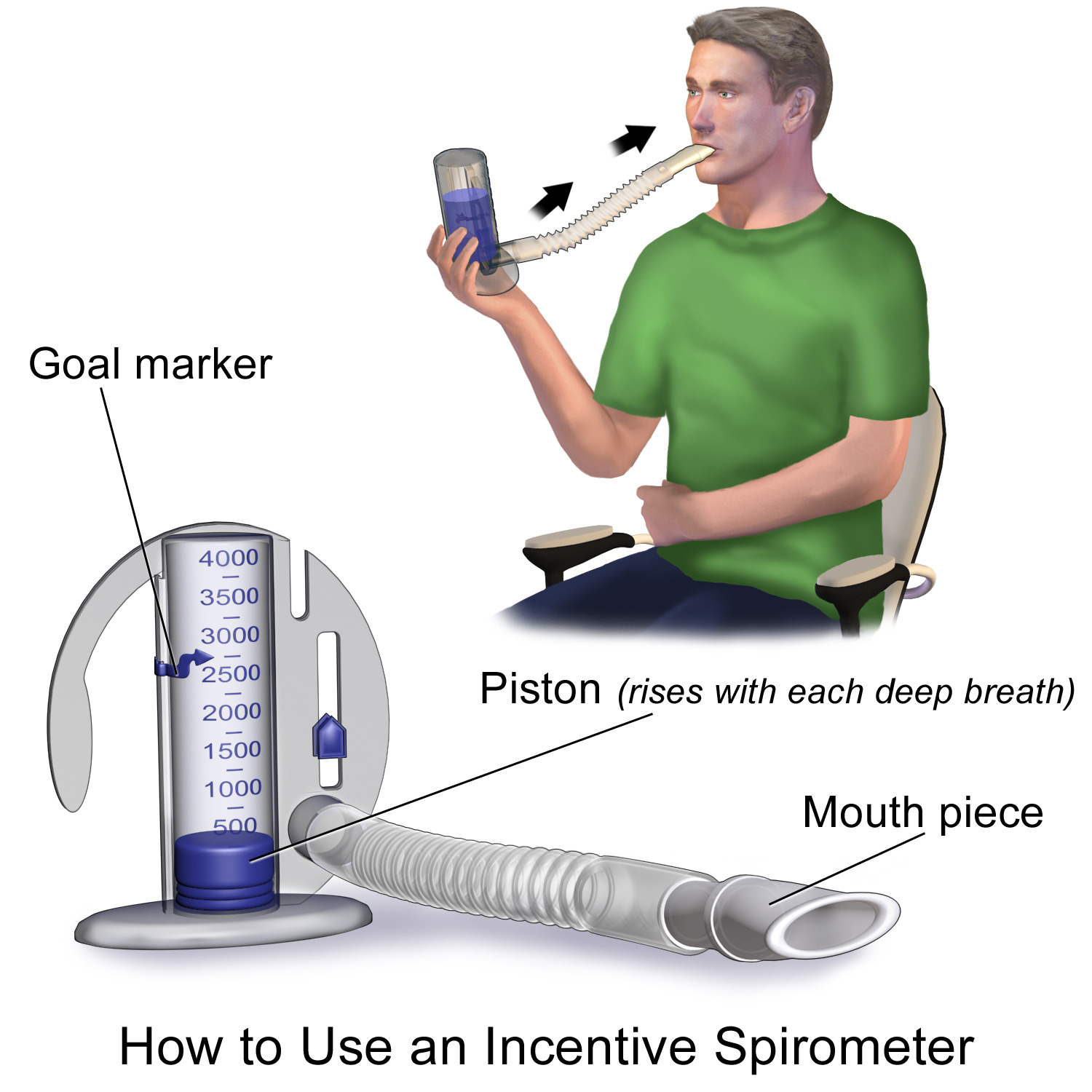 Trouble Breathing After Coronary Bypass Causes & Solutions » Scary Symptoms