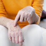 Can an Age Spot Turn into Melanoma? Yes, Says Doctor