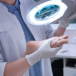 How Does Melanoma Get on the Bottom of a Toe?