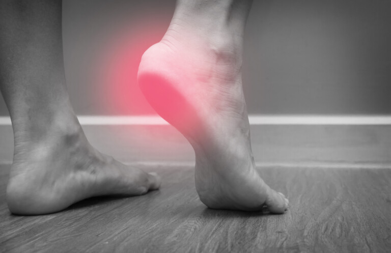 Exercises to Heal Heel Pain » Scary Symptoms