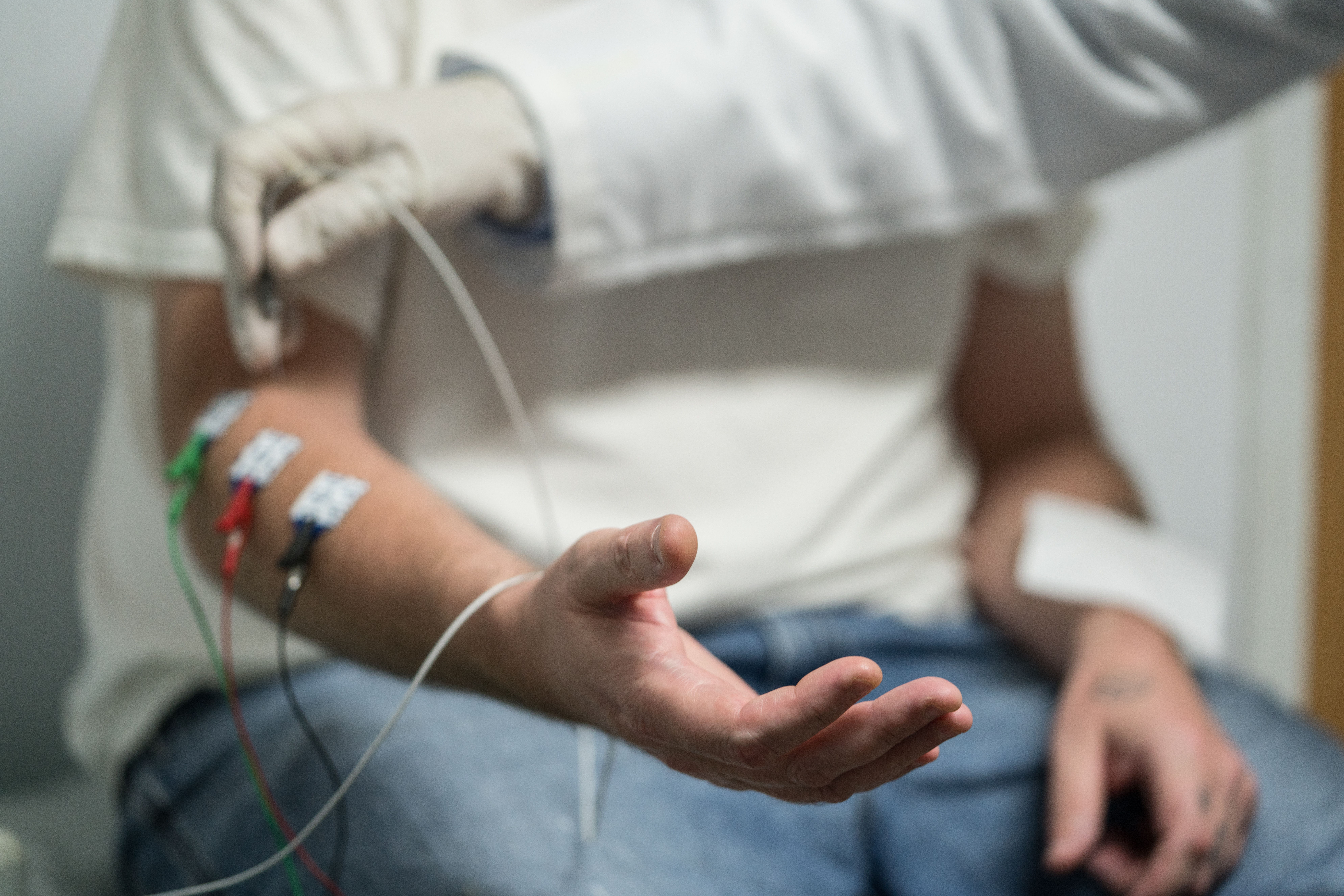 Can ALS Be Diagnosed with an EMG Test Alone?