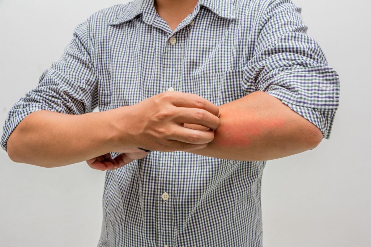 Itchy Arms and Legs in Winter Causes & Solutions » Scary Symptoms