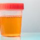 Drink Tons Of Water But Urine Is Still Dark Yellow? » Scary Symptoms