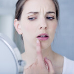 Causes of White Peeling Skin Inside Lip Include Cancer