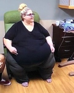 Obese women morbidly Body Mass