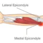 Complete Back & Biceps Routines You Can Do with Golfer's Elbow
