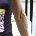 Veiny Woman’s Arm vs. Skinny Eating Disorder Arm