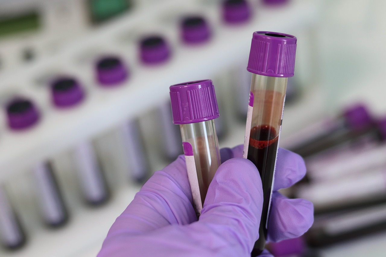 Can a Blood Test Detect a Brain Tumor?