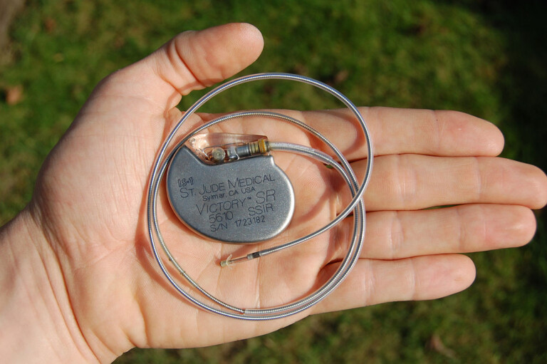 Do Pacemakers Prevent Atrial Fibrillation? » Scary Symptoms