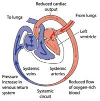 Best Type of Exercise for Improving Ejection Fraction » Scary Symptoms