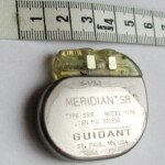 Can a Pacemaker Implant Damage the Vagal Nerve?
