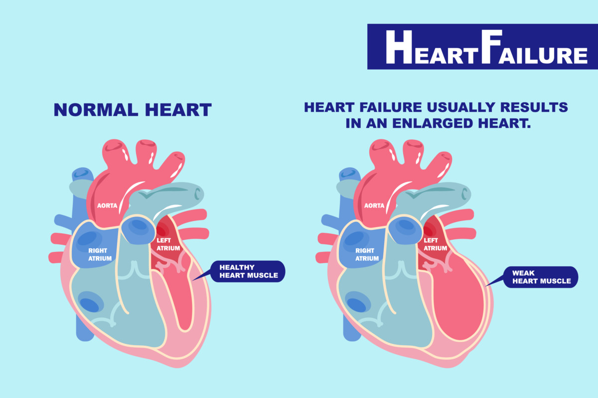 is low ejection fraction dangerous