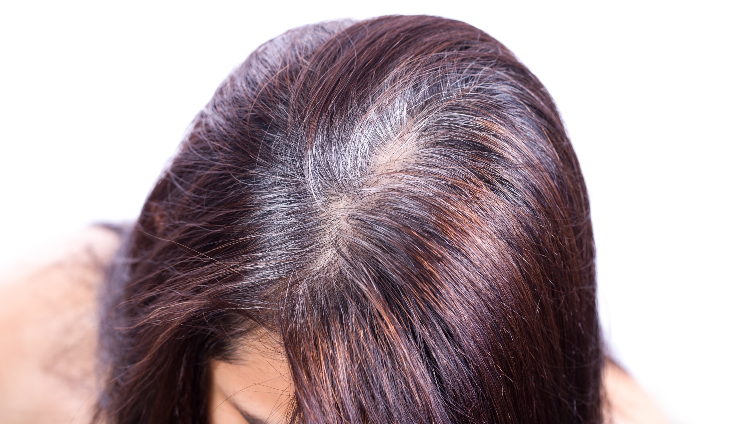 Can Grey Hair Be Caused by Minoxidil? » Scary Symptoms