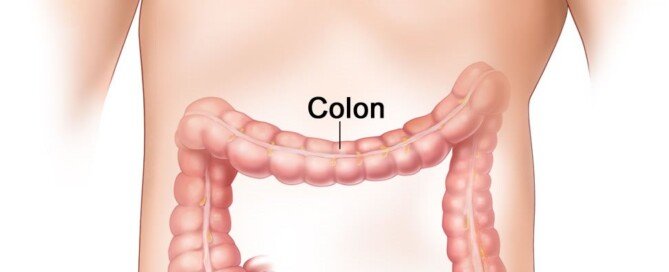 Colon Cancer Symptoms Archives Scary, What Causes Wide Flat Stools