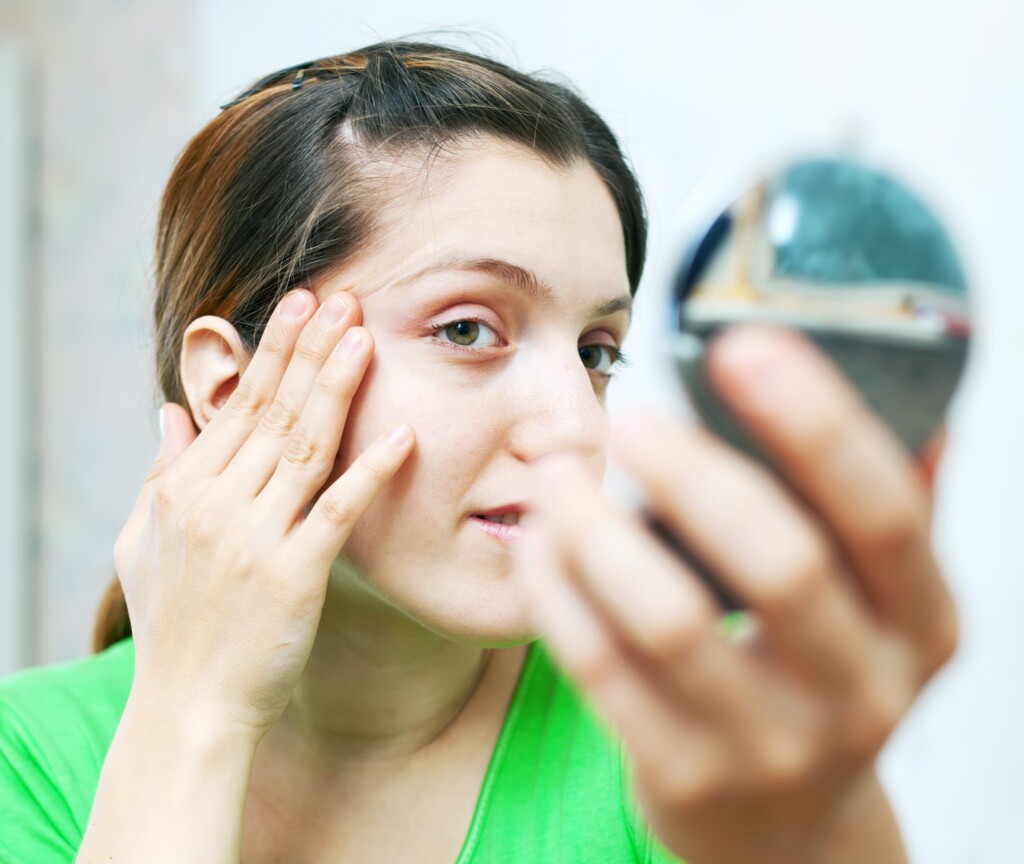 Really Dry Skin Around Eyes Causes & Solutions » Scary Symptoms