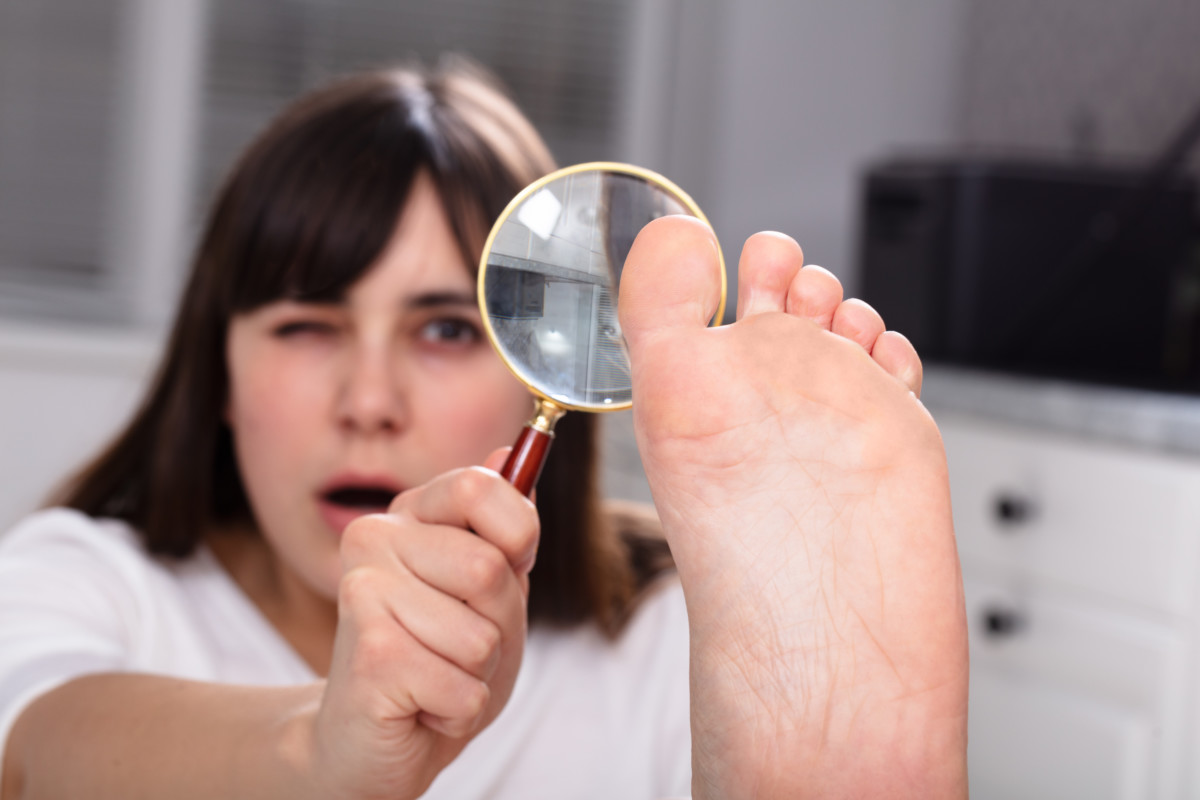 White Patches on Big Toenail Causes, Solutions » Scary Symptoms
