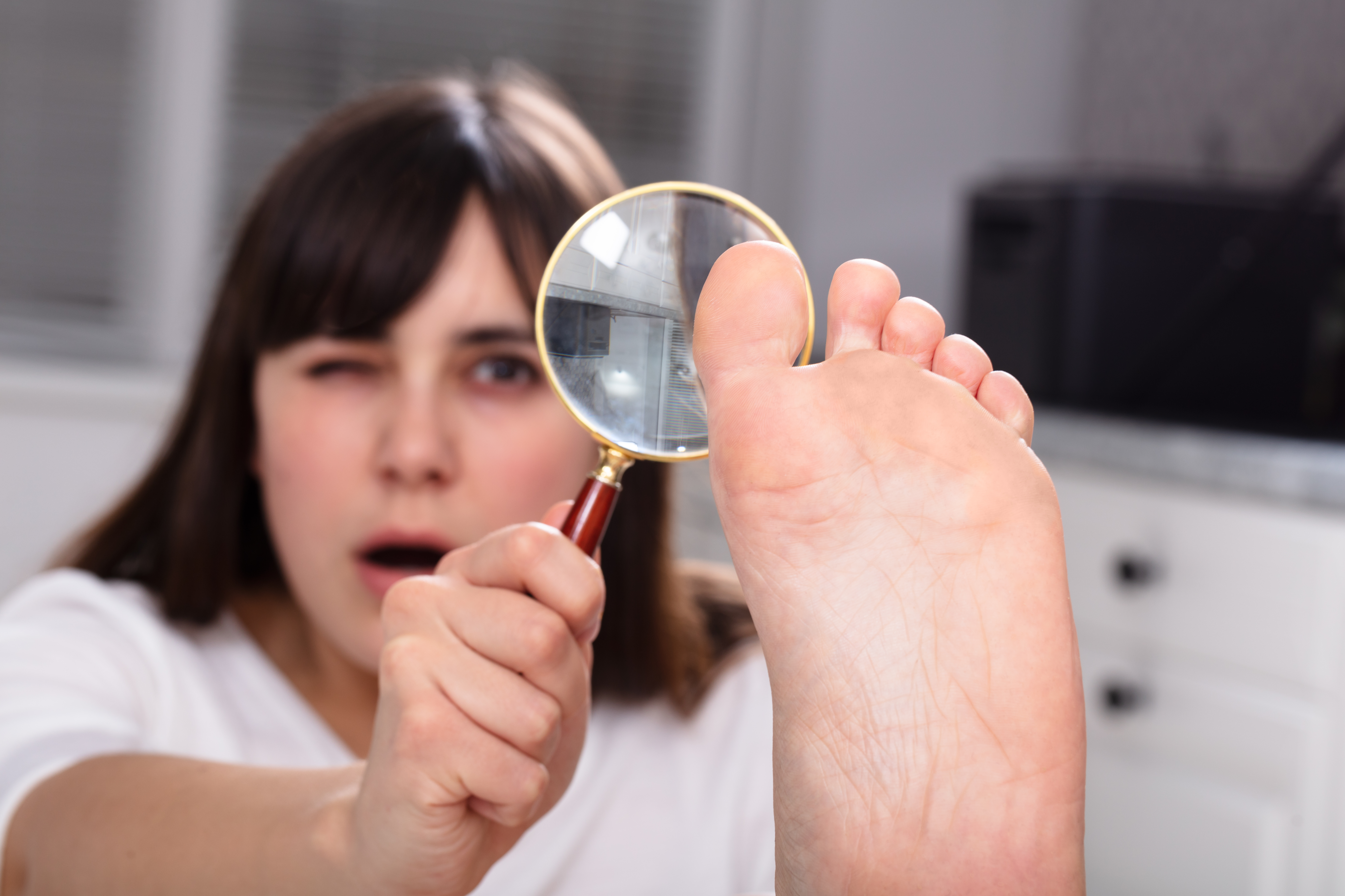 White Patches on Big Toenail: Causes, Solutions