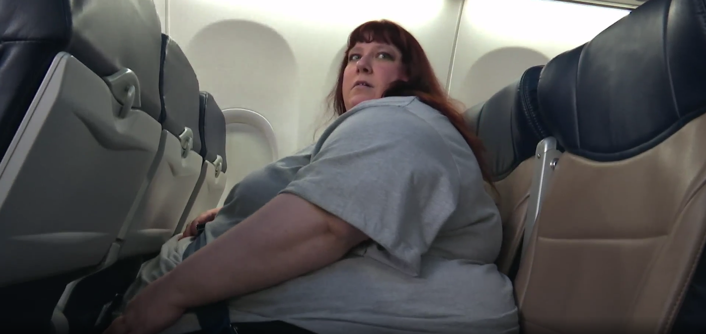 Hypothalamic Obesity: How Hungry Do Patients Get?