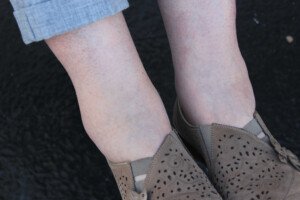 At What Age Do Ankles Start Swelling?