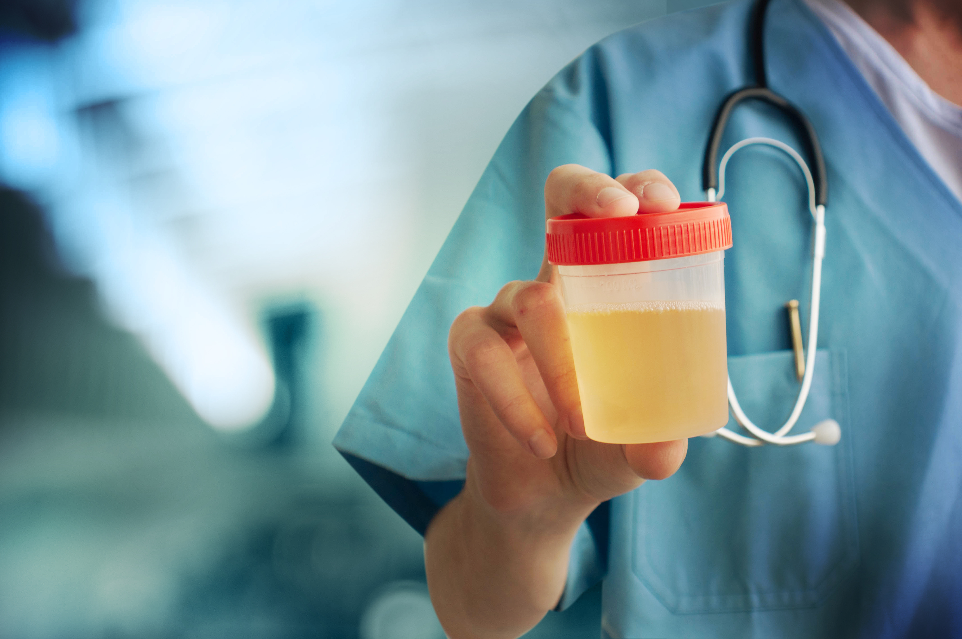 What Causes Cloudy Urine Nhs