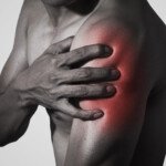 How to Relieve Muscle Cramps from Clavicle Fracture