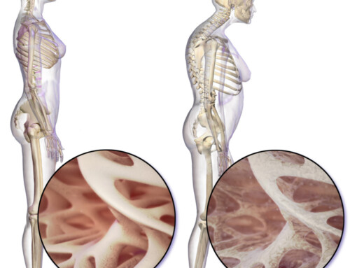 Top 3 Exercises to Prevent Osteoporosis in Women Over 50