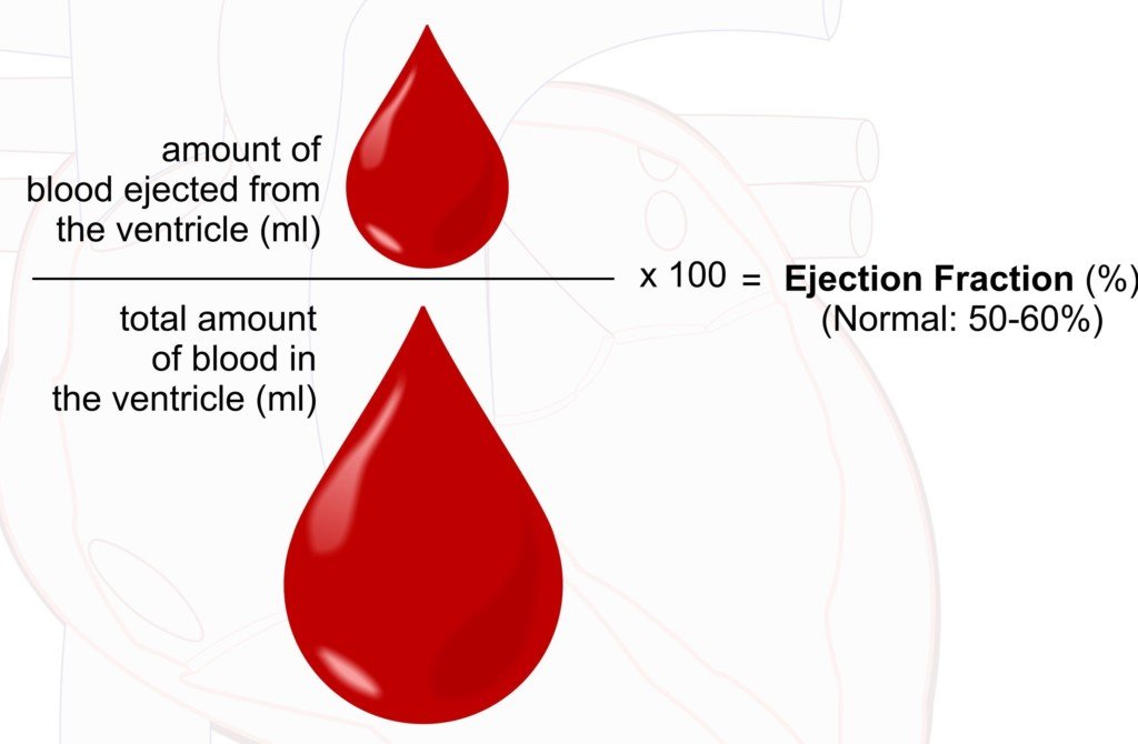 The Lowest Ejection Fraction a Person Could Live With? » Scary Symptoms