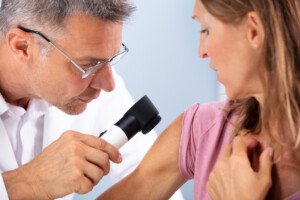 Mole Bleeds After Scratching: Melanoma Risk or IS It Melanoma?