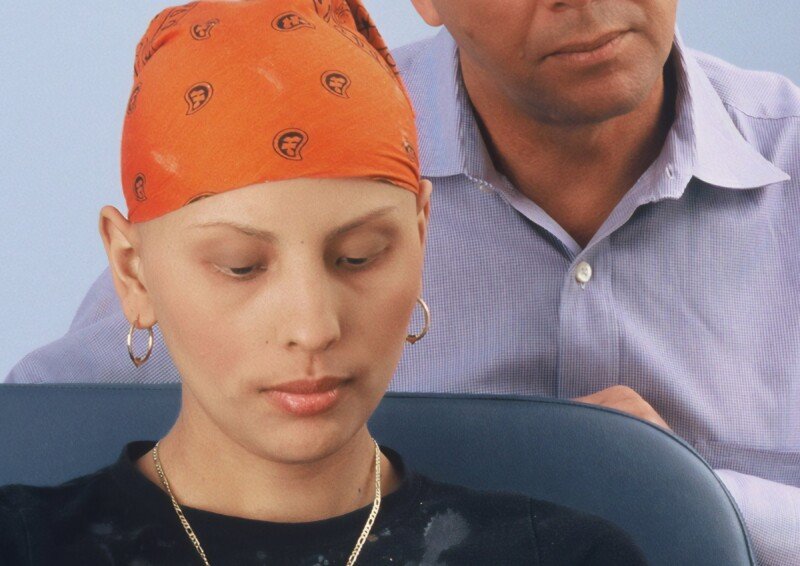 What Never to Say to Woman with Permanent Hair Loss from Chemo » Scary Symptoms
