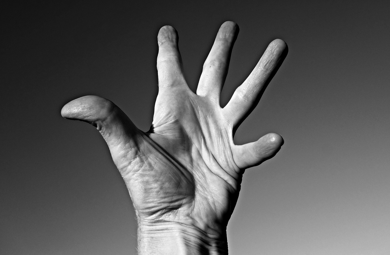 Can ALS Cause Hand Symptoms that Mimic Carpal Tunnel Syndrome?