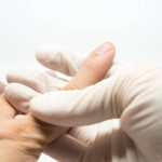 Numb Tingling Finger the Only Symptom of a Herniated Disc?
