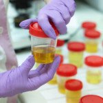 Should You Worry About Trace Ketones in a Urine Sample?