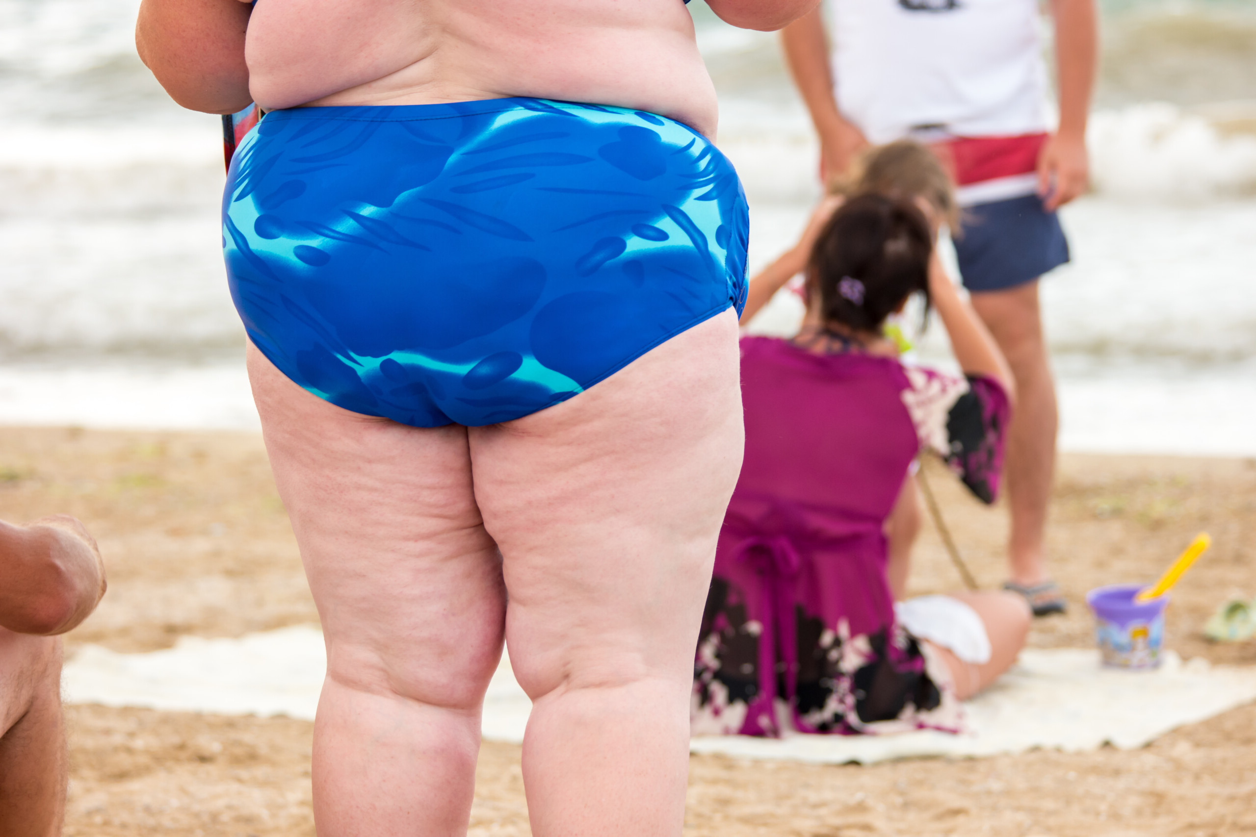 Why Courage Does Not Mean Wearing a Bikini if You're Fat