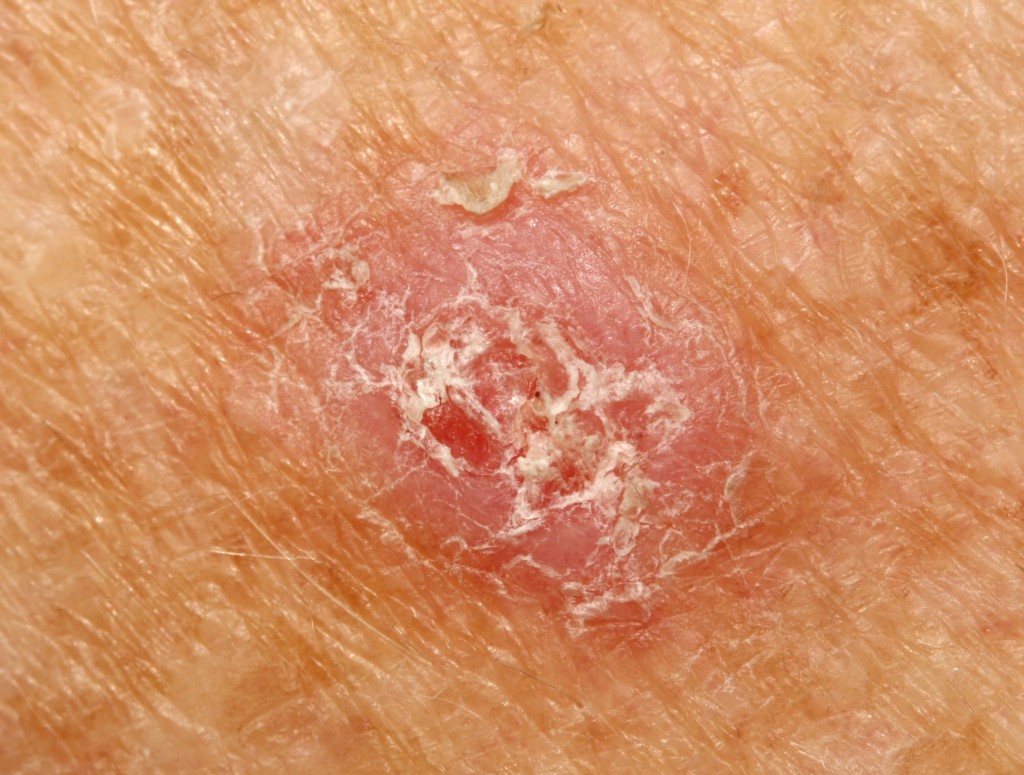 What Causes Rough Patches On Skin