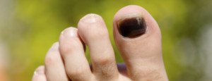 Can Diabetes Cause Toenails to Turn Black? » Scary Symptoms