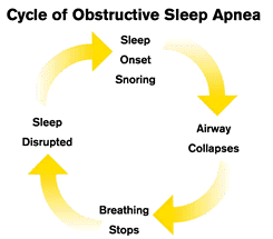 Sleep Apnea: How a Dentist Can Help You Get Real Rest at Night