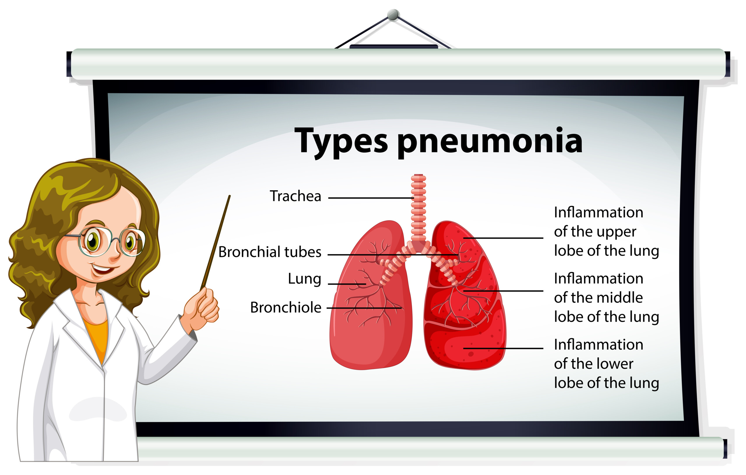 Can Non-Walking Pneumonia Go Away On Its Own?