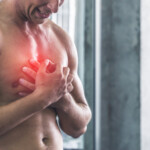 Can Exercise Cause INTENSE Chest Pain from GERD?