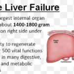Can the Liver Suddenly Fail Acutely from Heart Failure?