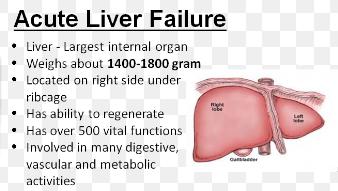 Can the Liver Suddenly Fail Acutely from Heart Failure?