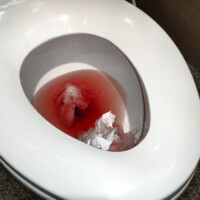 How Does Urine Look When There’s Blood In It?